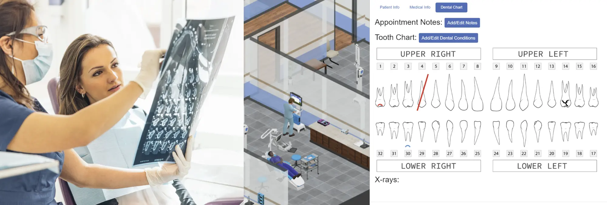 Dental Simulation Screenshot